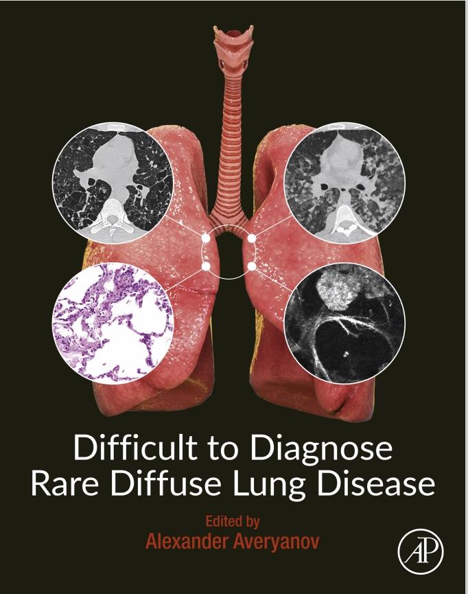 Difficult to Diagnose Rare Diffuse Lung Disease